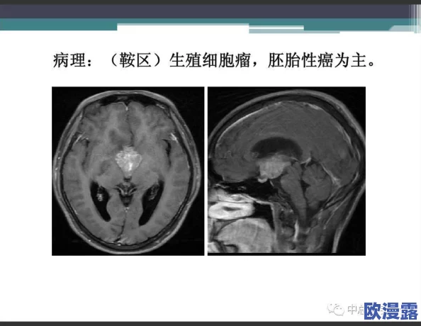 裸体大隂户特写:研究生物学中的生殖结构及其对生态系统的重要影响与应用 裸体大隂户特写:研究生物学中的生殖结构及其对生态系统的重要影响与应用