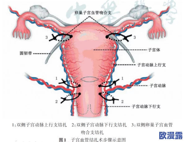破苞XXXX出血HD:探讨产后出血的原因、处理方法及预防措施的综述与研究分析 破苞XXXX出血HD:探讨产后出血的原因、处理方法及预防措施的综述与研究分析